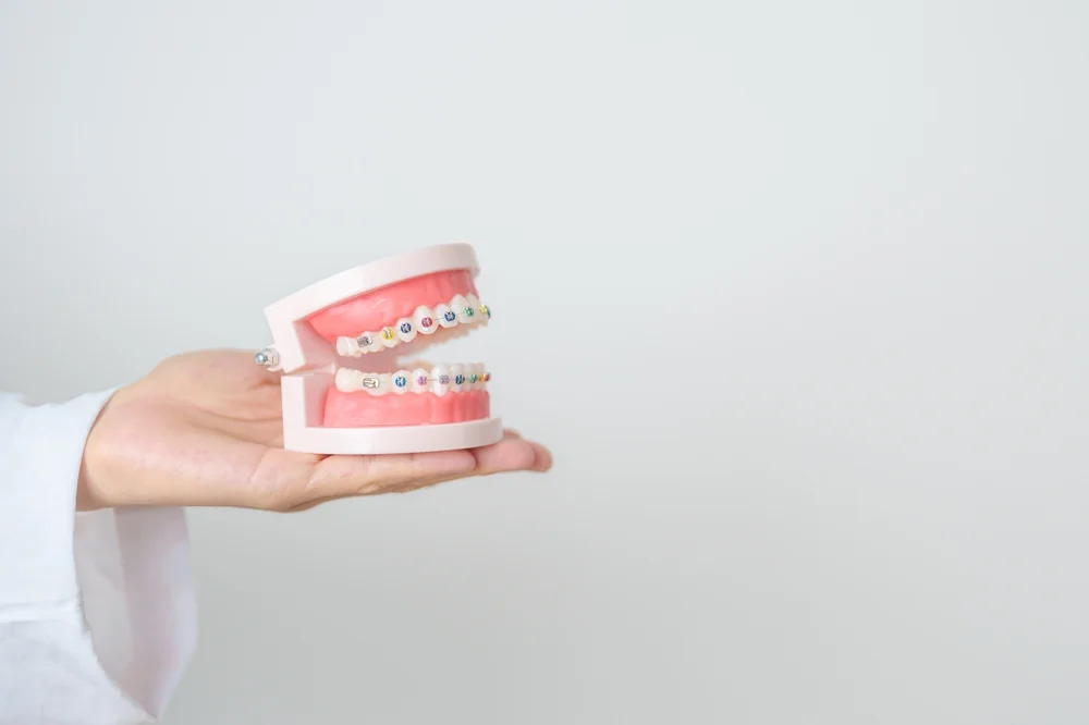 invisalign