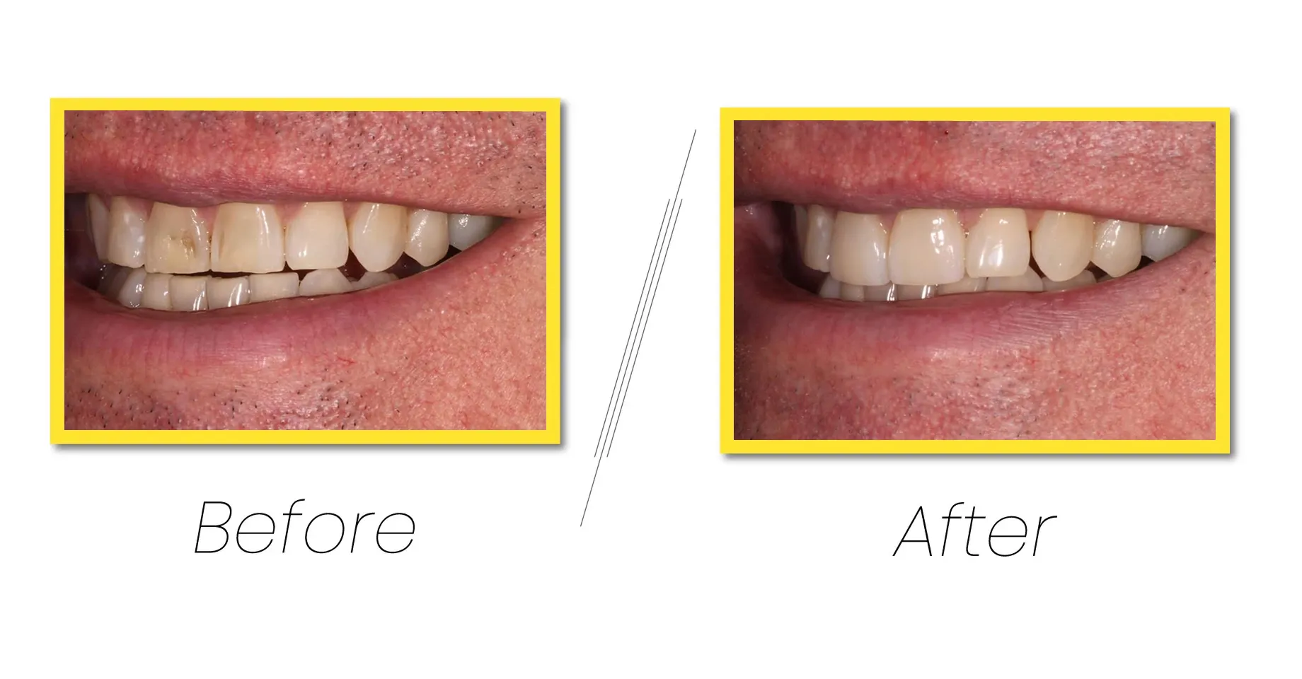 Explore our general & family dentistry in north quincy