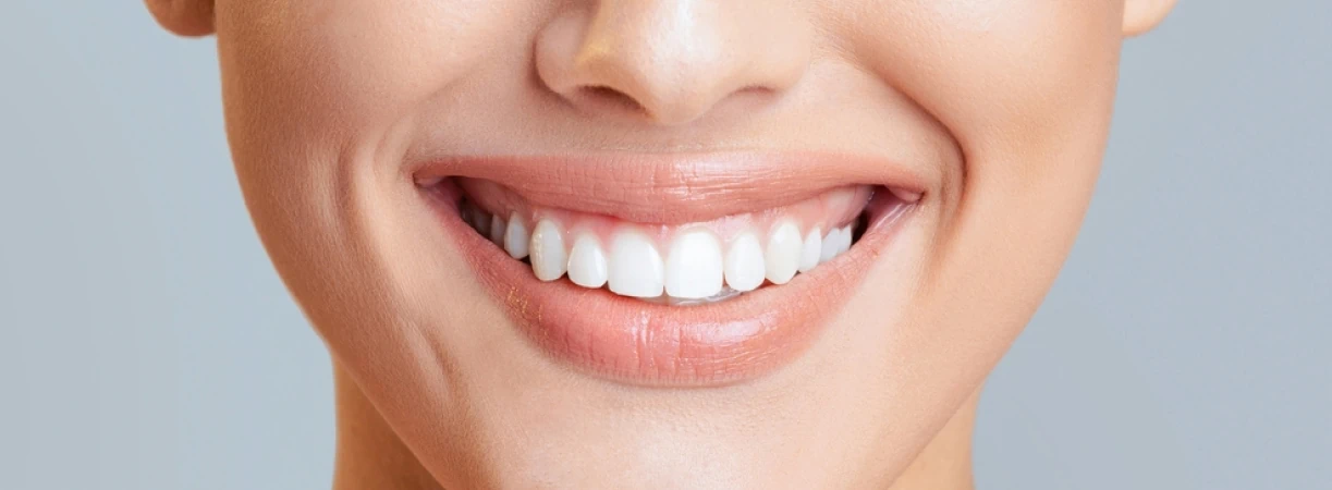 7 Signs It Might Be Time for a Smile Makeover