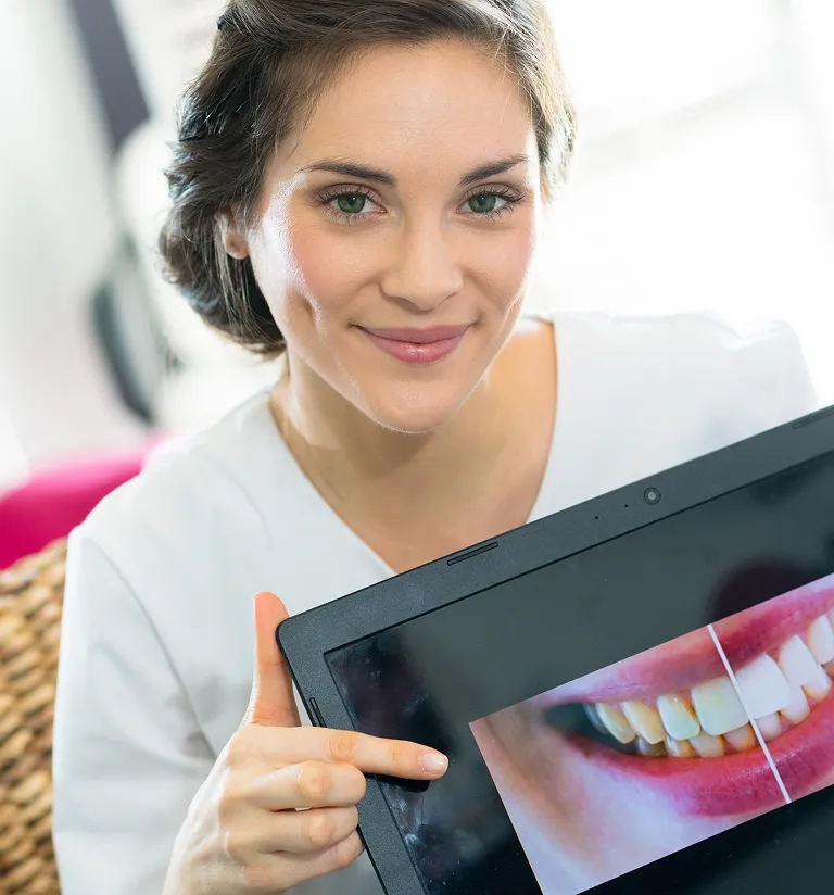 Benefits Of Virtual Smile Design