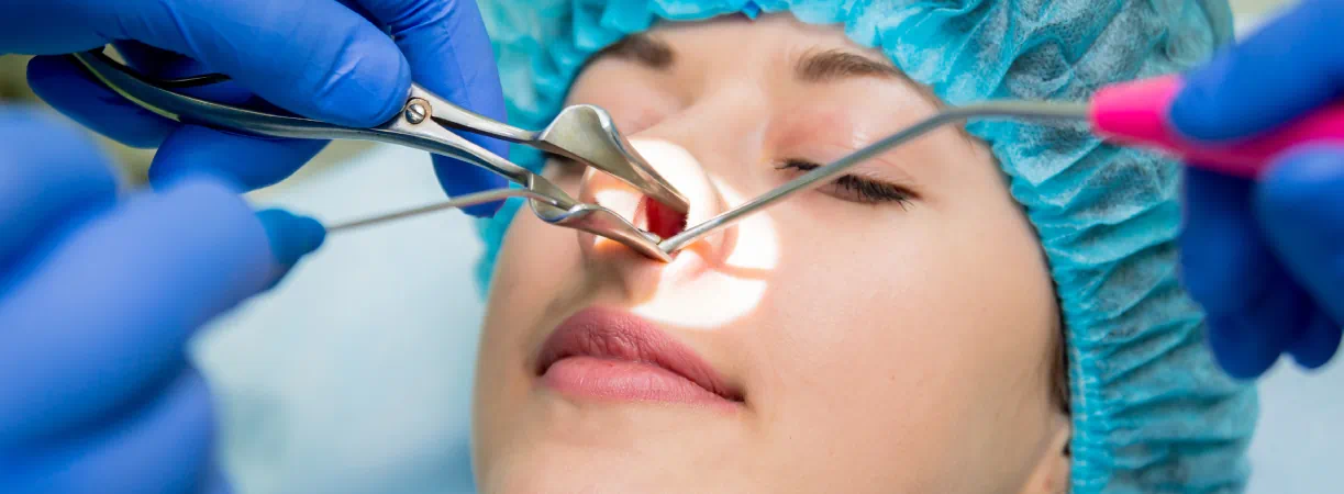 Functional Endoscopic Sinus Surgery (FESS)