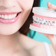 Modern False Teeth – All You Need To Know