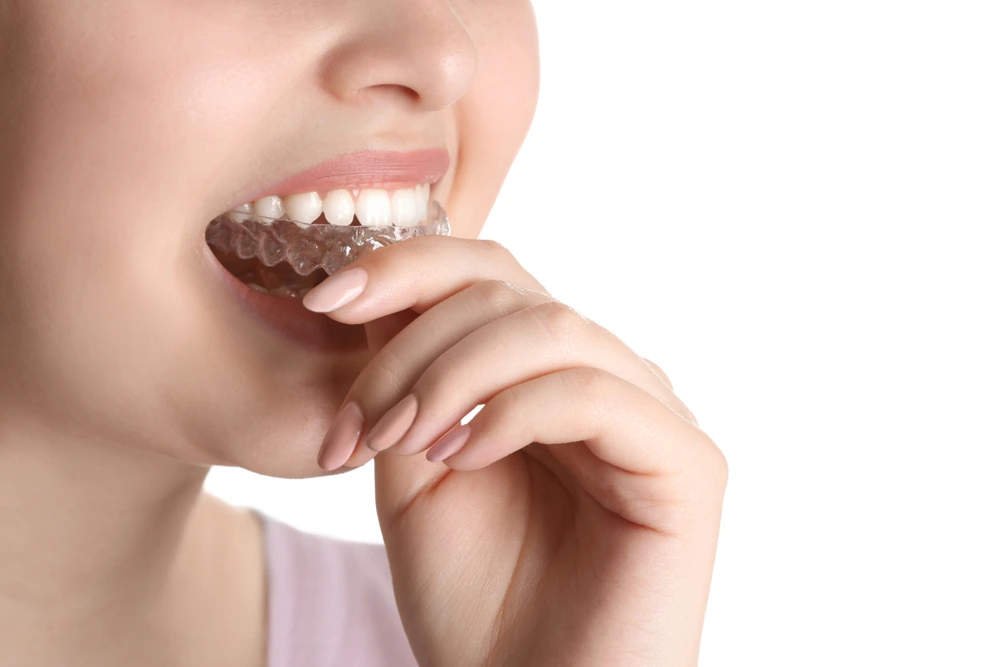 Invisalign