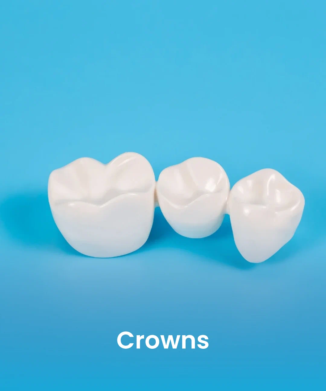 Dental crowns for tooth restoration