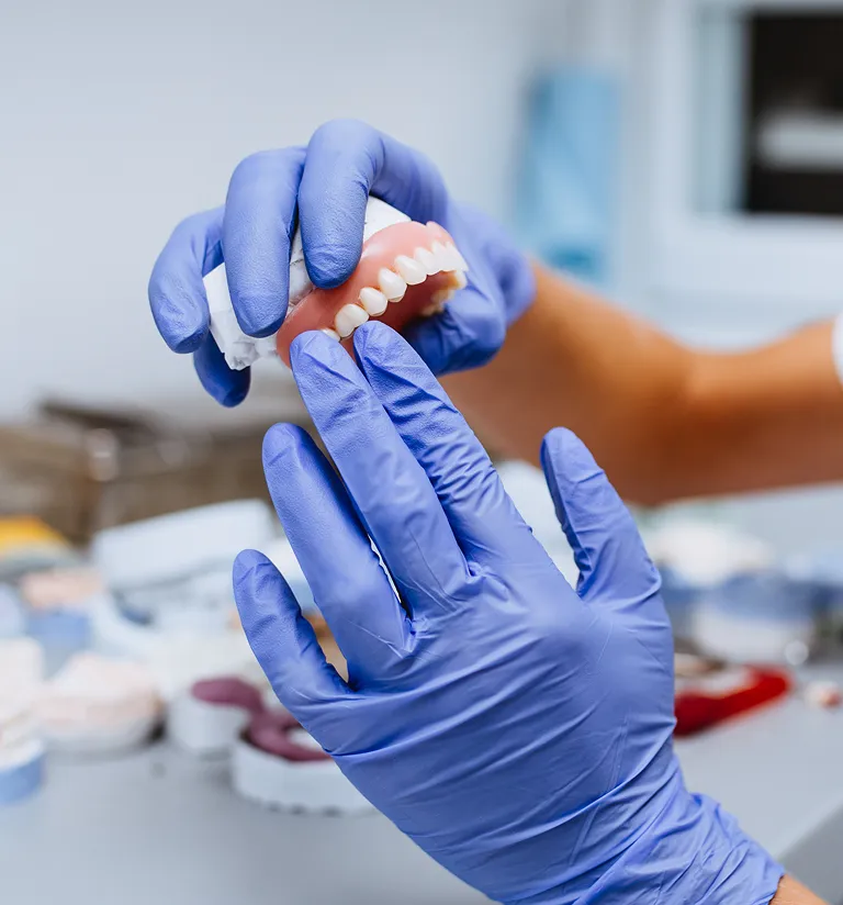 Implant Supported Dentures Model