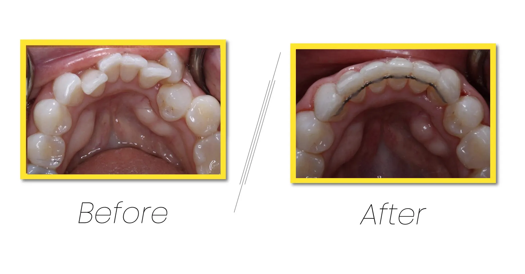 Best dental treatments procedure for your happy smile.