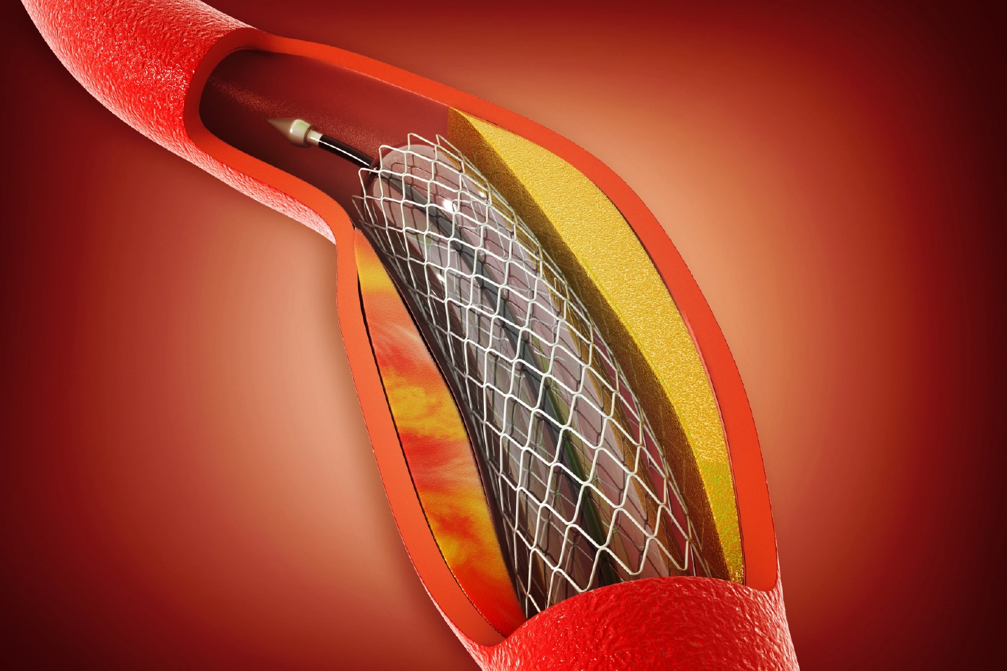 Top 5 Tips for Maintaining Healthy Teeth at Home