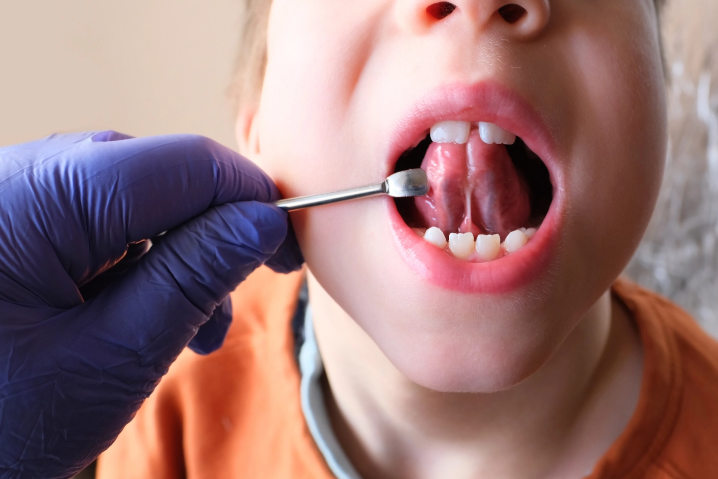 how do I know if my baby has a tongue tie