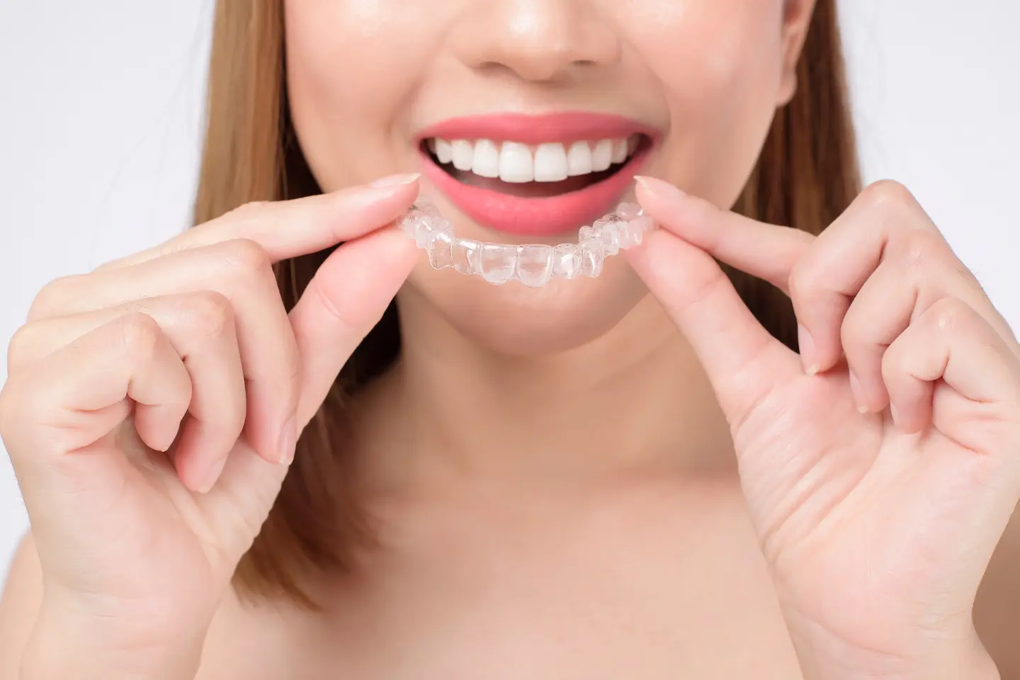 Game-Changing Invisalign Treatment