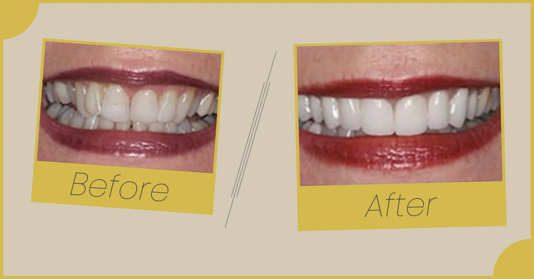 Showcasing Dental Care Transformations at Smile Saver Dental