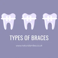 Types of Braces