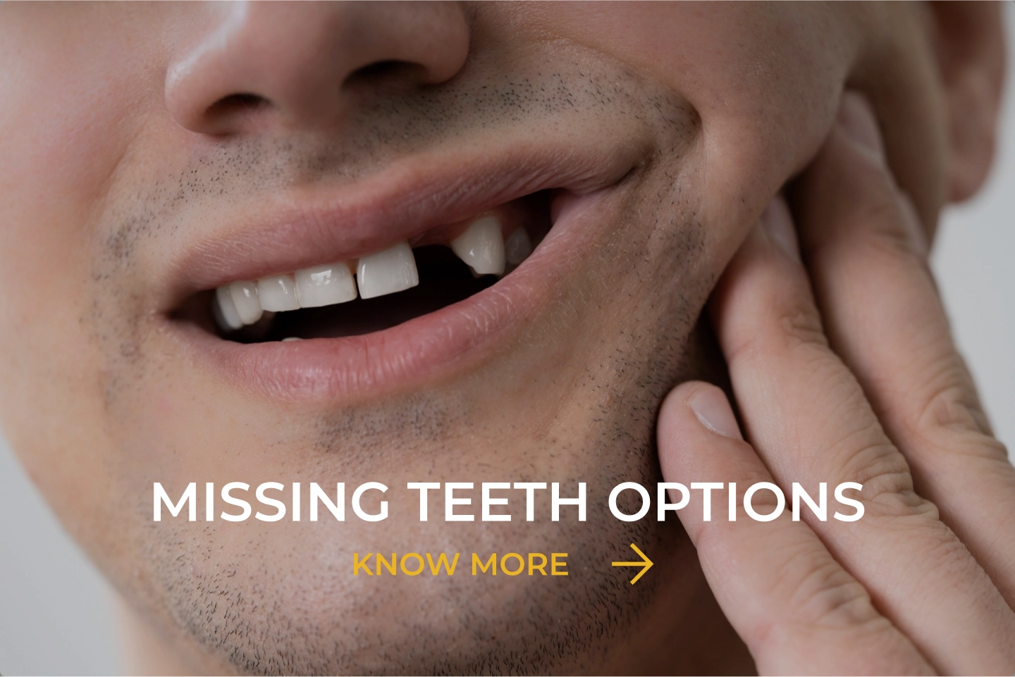 Missing teeth options