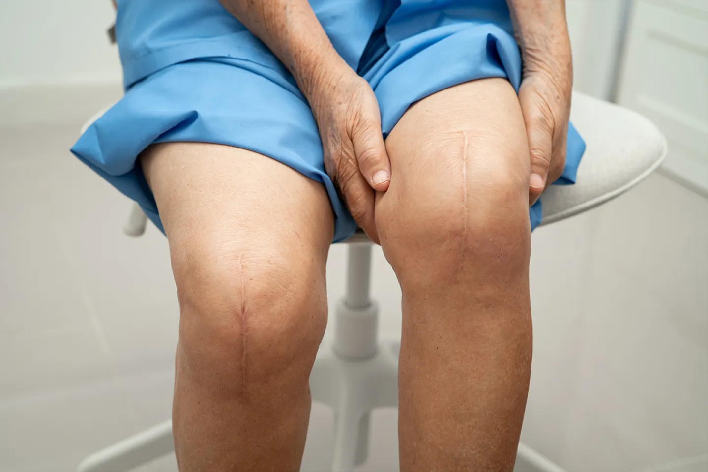 Total Joint Replacement Rehabilitation (Hip, Knee, Shoulder)
