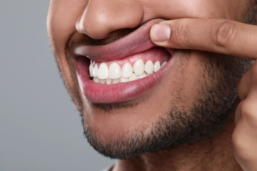 Gum Disease