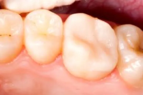 main-image