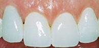 main-image