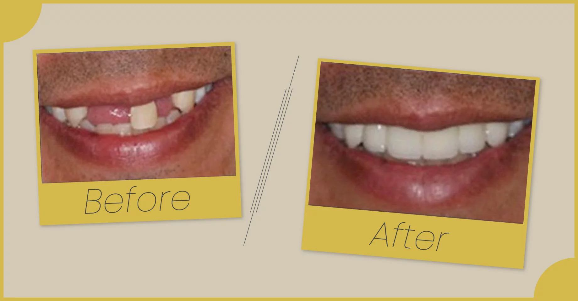 Highlighting Dental Transformations at Smile Saver Dental