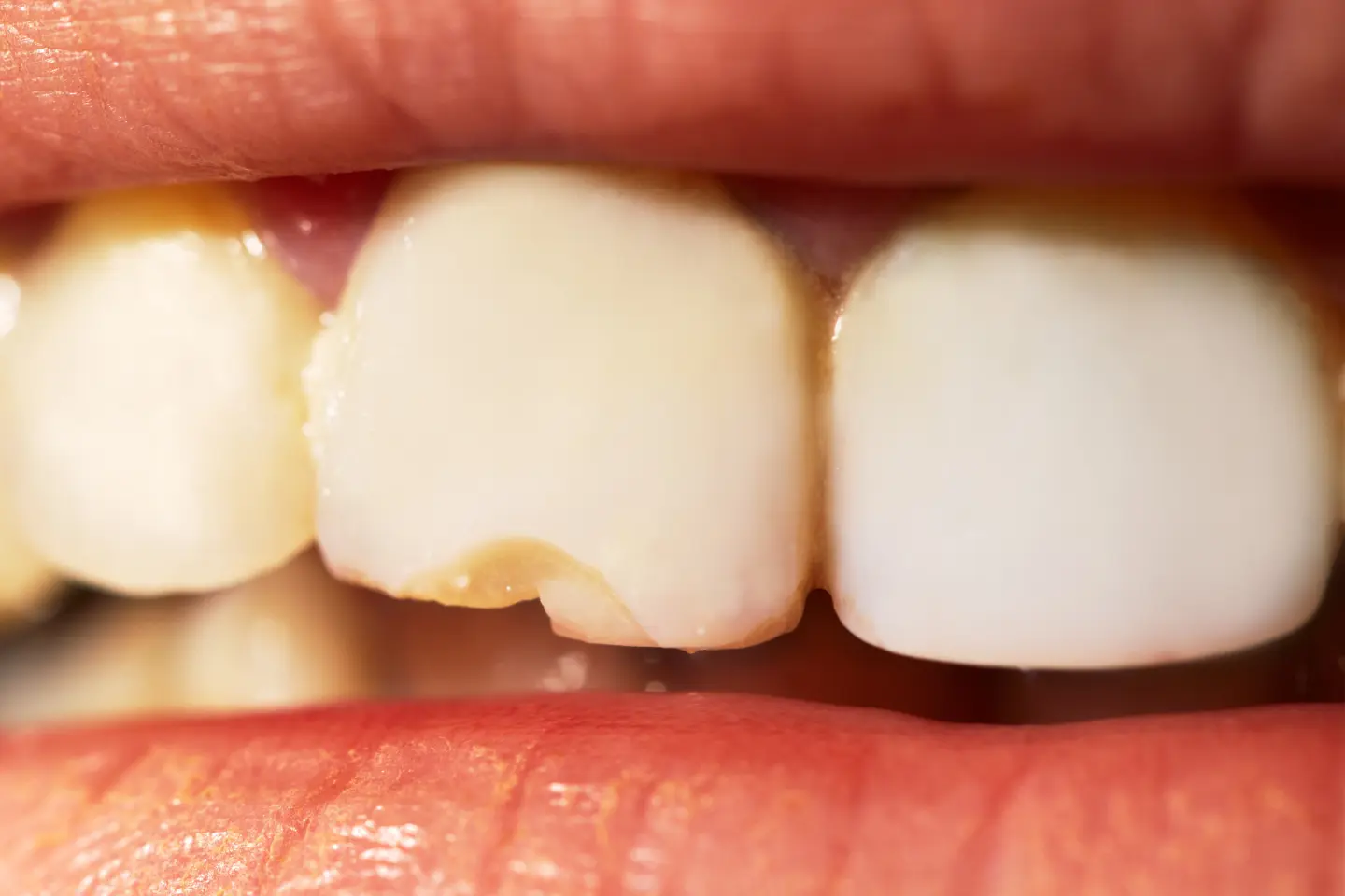 Trouble with a Tiny Crack