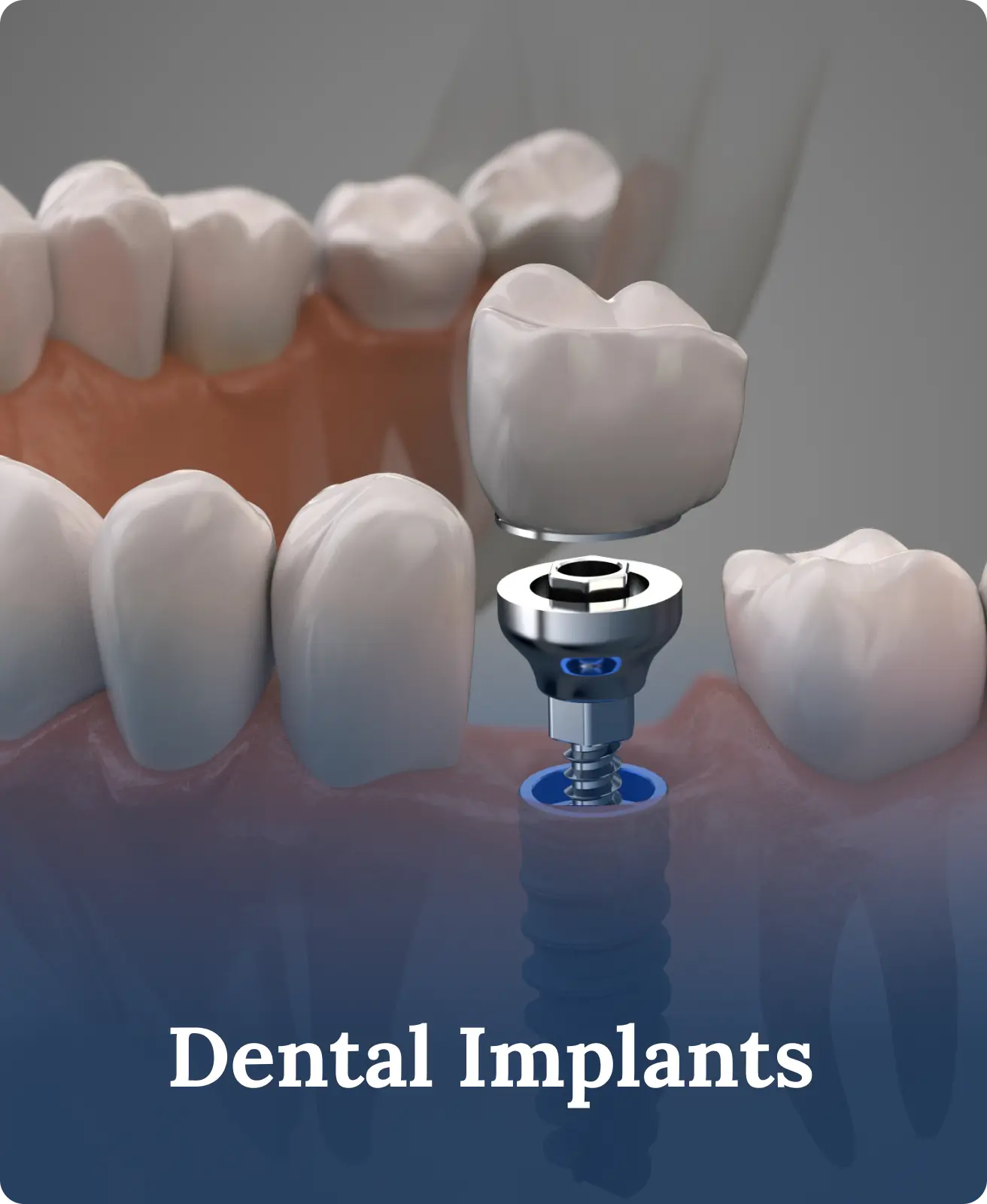 The Importance of Regular Dental Cleanings for a Healthy Smile