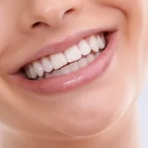Bonding or veneers? The ‘doing less’ question we ask before touching a tooth