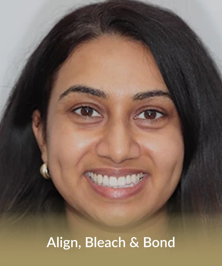 Align, bleach