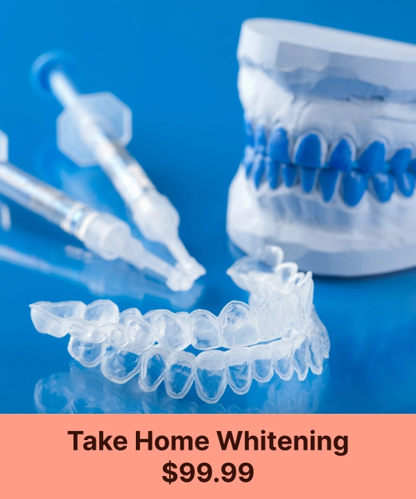 Take-home Whitening at Sacramento West Dental,CA