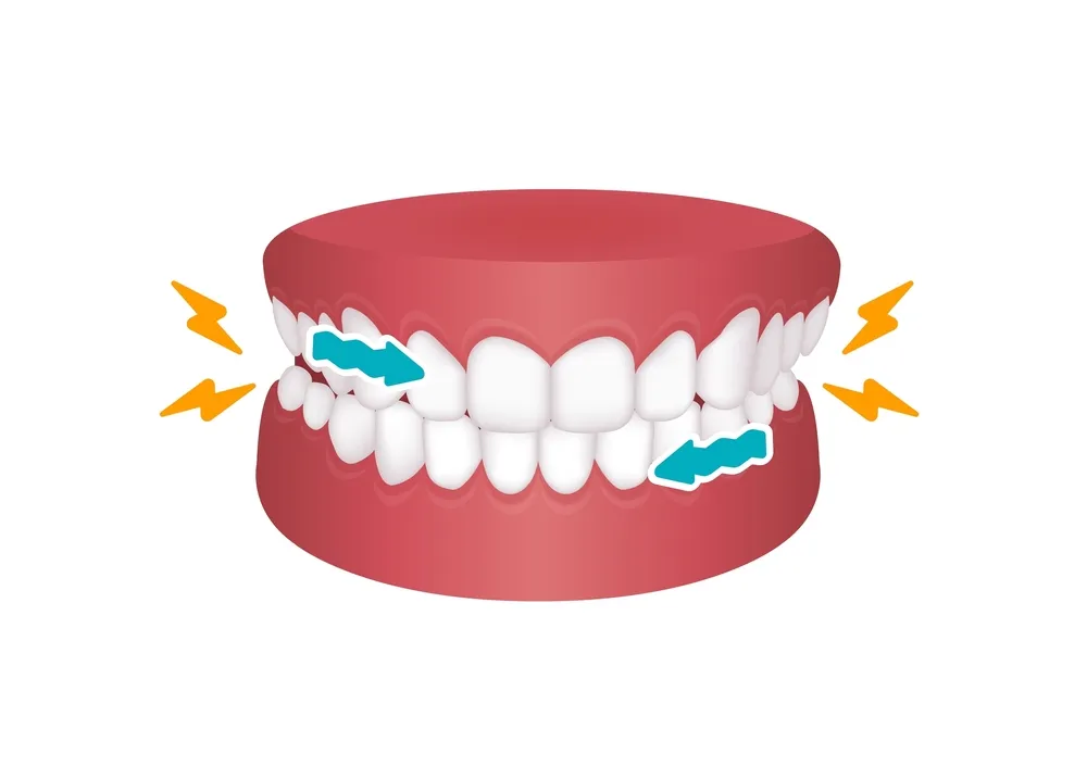 Grinding Your Teeth