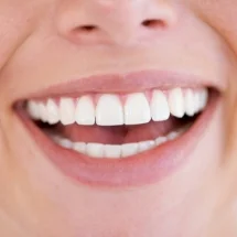 How Much Does a Smile Makeover Cost in Leicester and Corby? (And Why the Price Is Only Part of the Story)