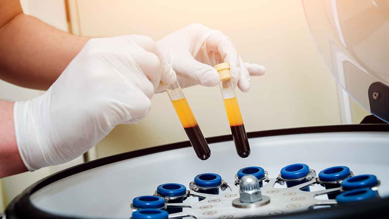 Patient Experiencing Lasting Relief With Regenerative Joint Therapy.