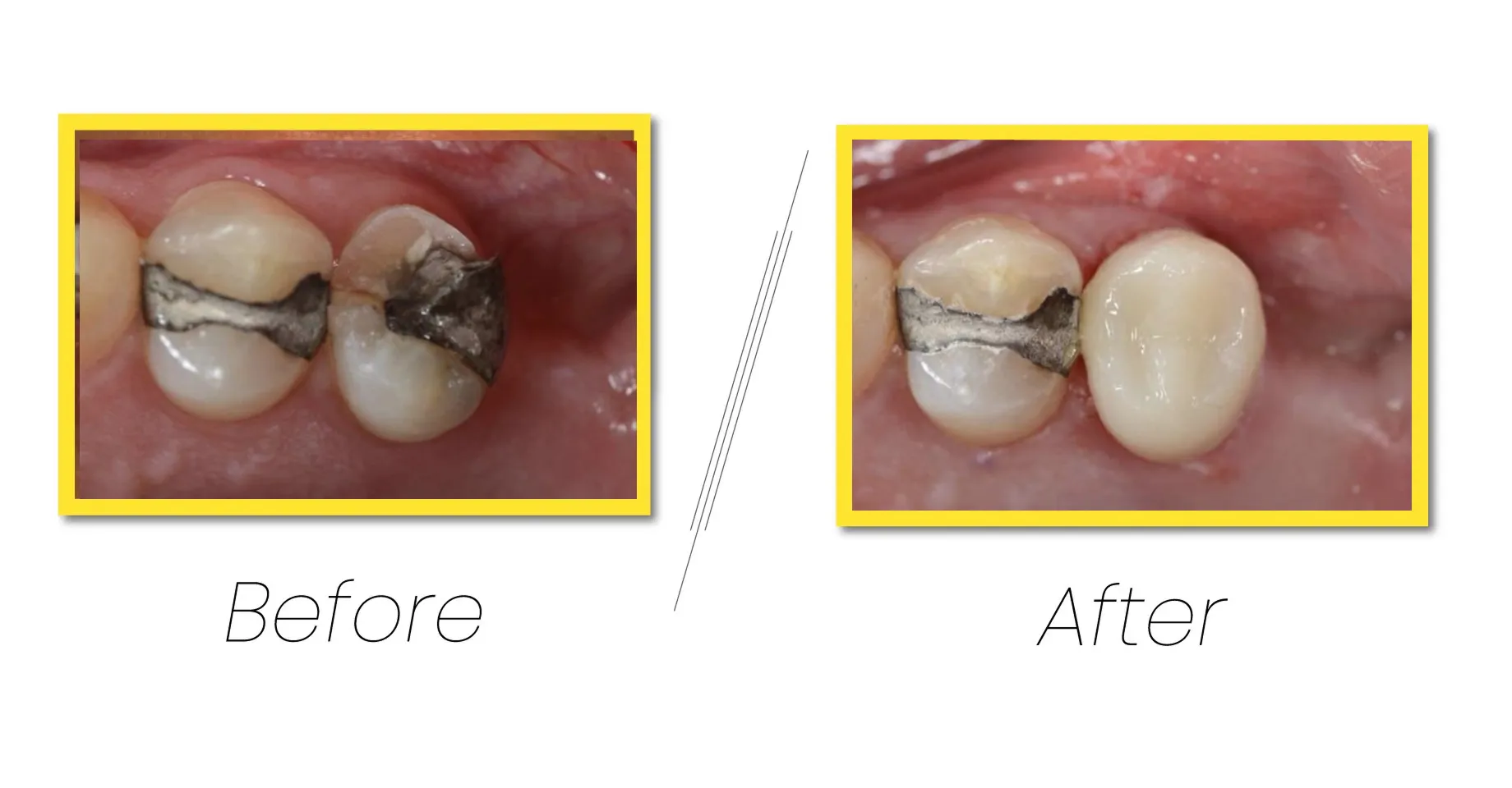 Laser Dentistry, Precision care with advanced technology.