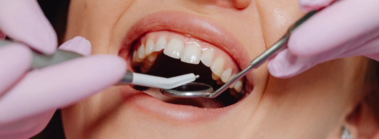 Gum Surgery