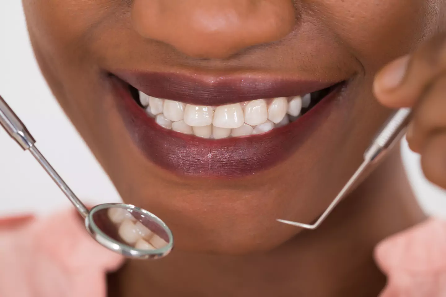 New York Professional Teeth Whitening