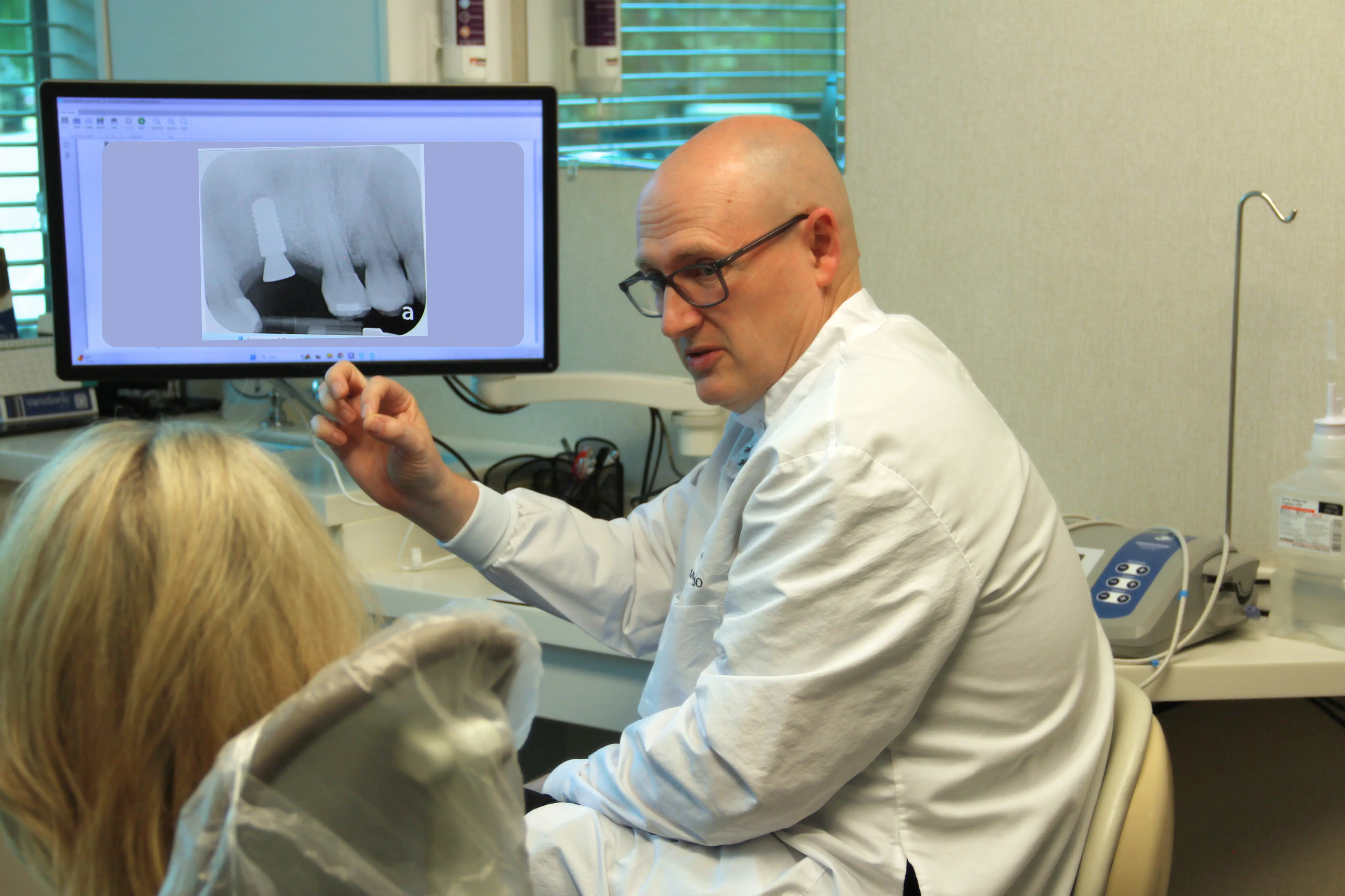 Benefits of Dental Implant