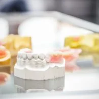 Types of False Teeth That You Can Use To Enhance Your Smile