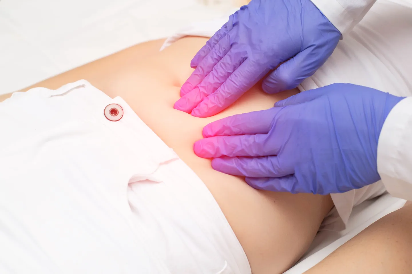 Genital Tuberculosis