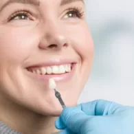 How Long Does Composite Veneers Last?