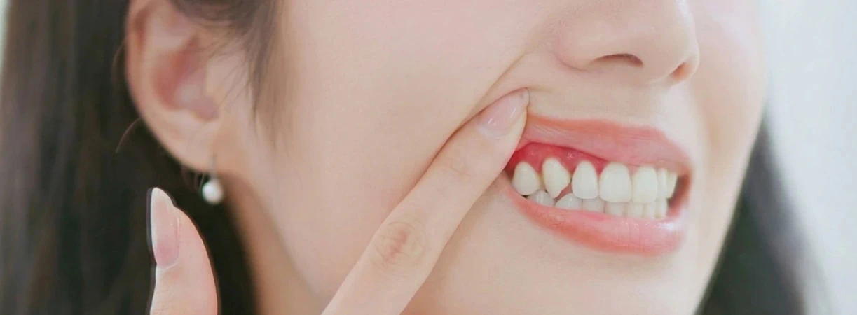 Periodontal (Gum) Care