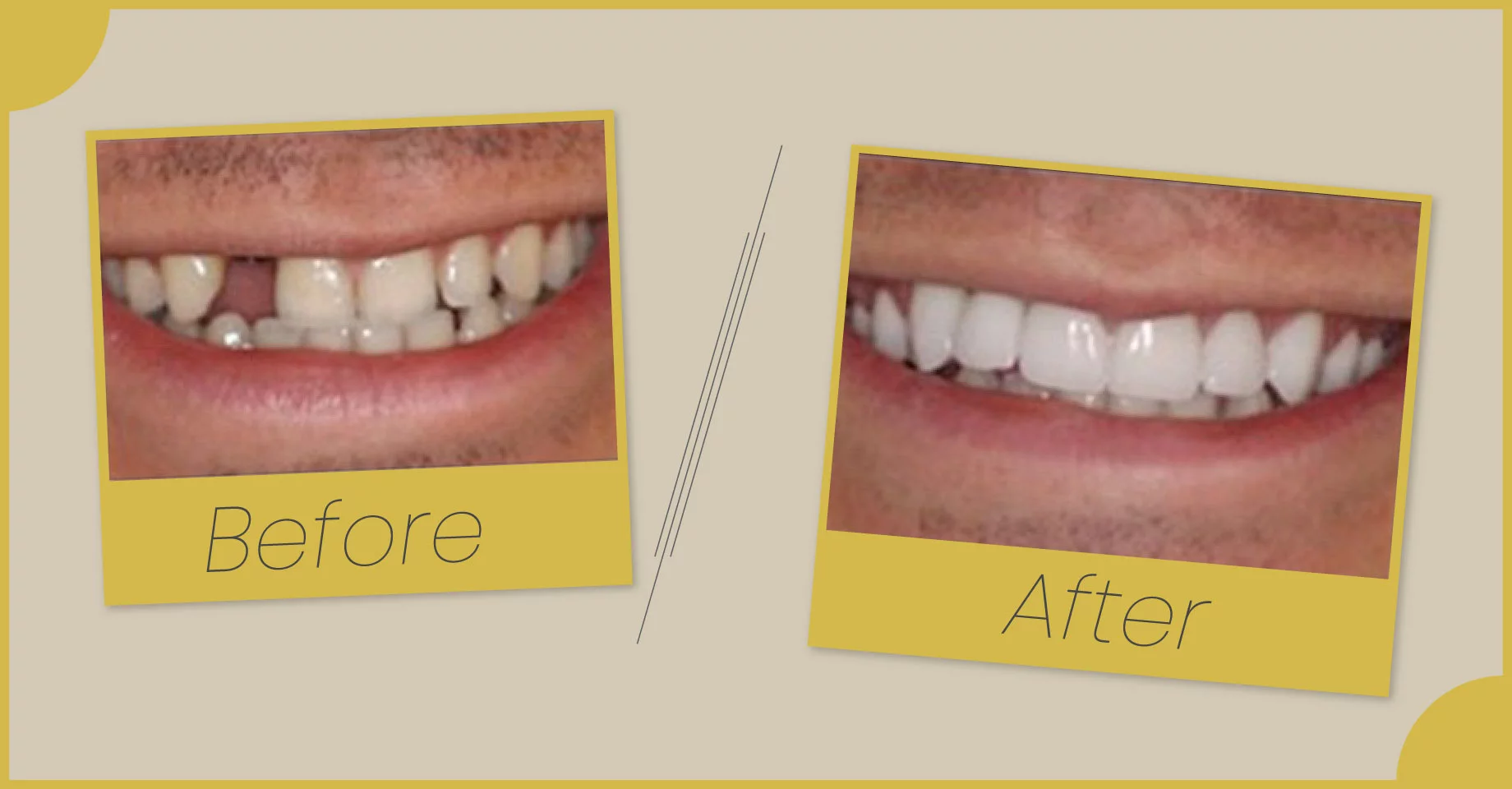 Before and after Comparison of Dental Treatment Results.