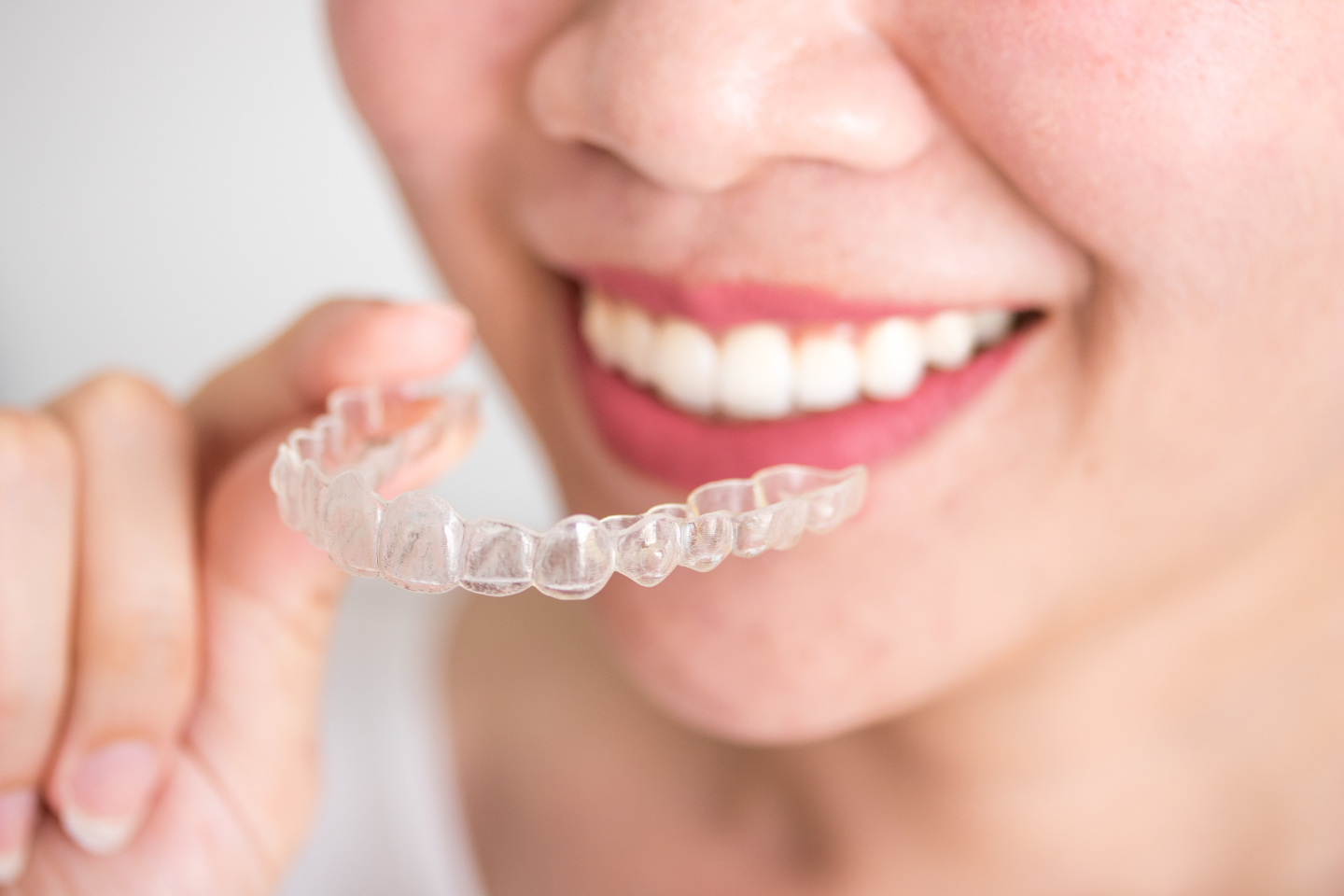 Know About Invisalign®