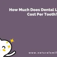 How Much Does Dental Lumineers Cost Per Tooth?