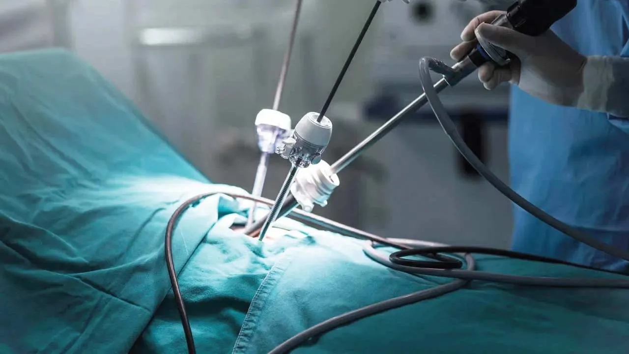 minimally invasive cancer surgery diagram
