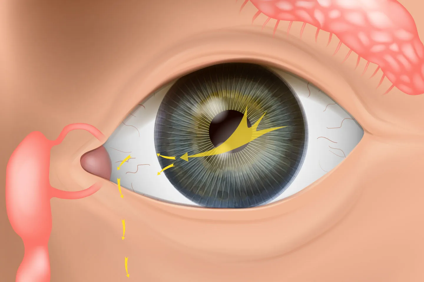 lacrimal-surgery.image