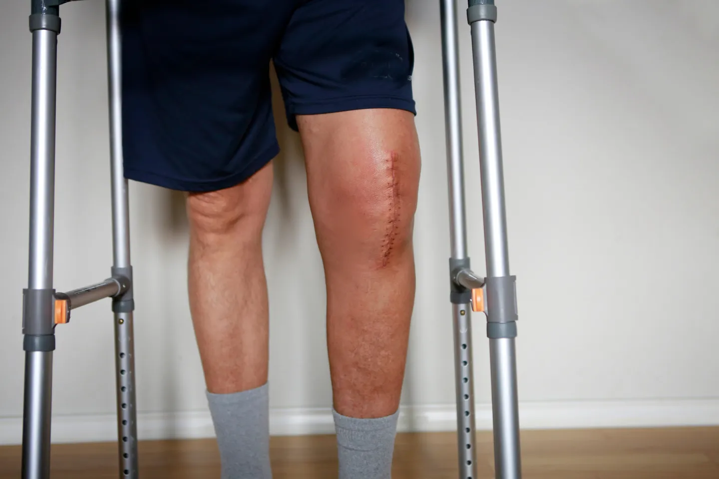 When Is It Time for Joint Replacement Surgery?