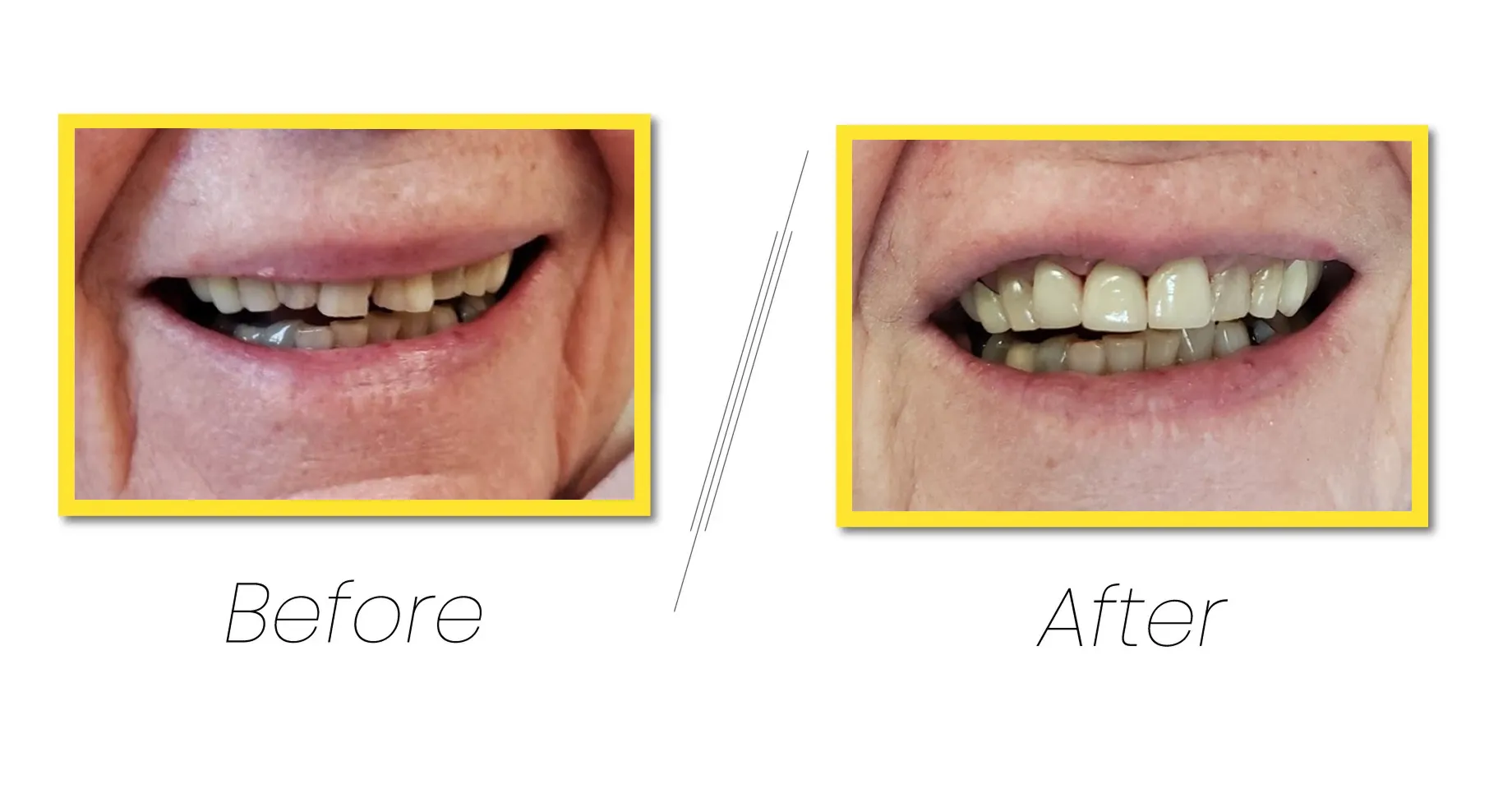 Best dental treatments procedure for your happy smile.
