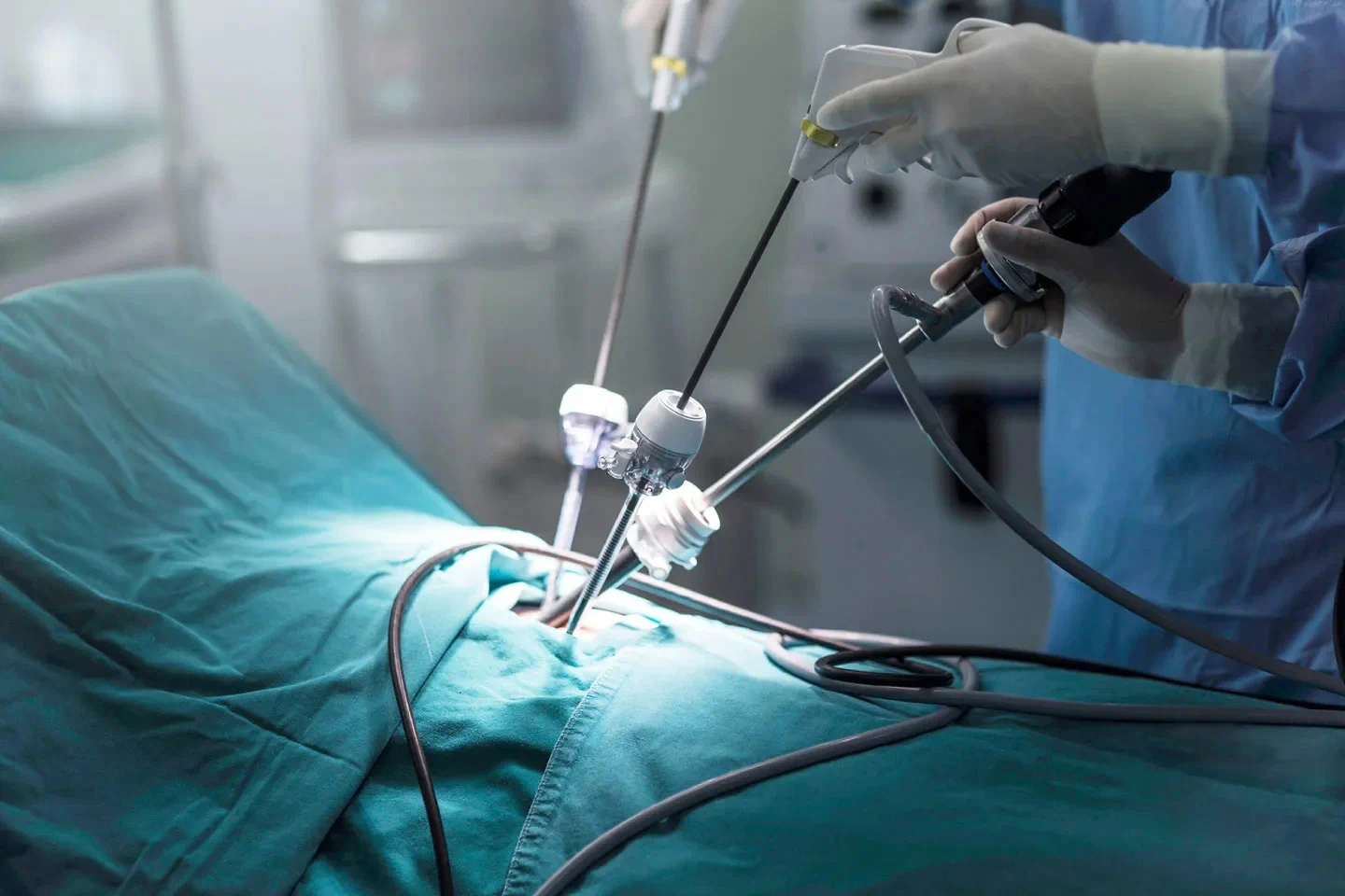 Common Conditions Treated with Laparoscopy in Women