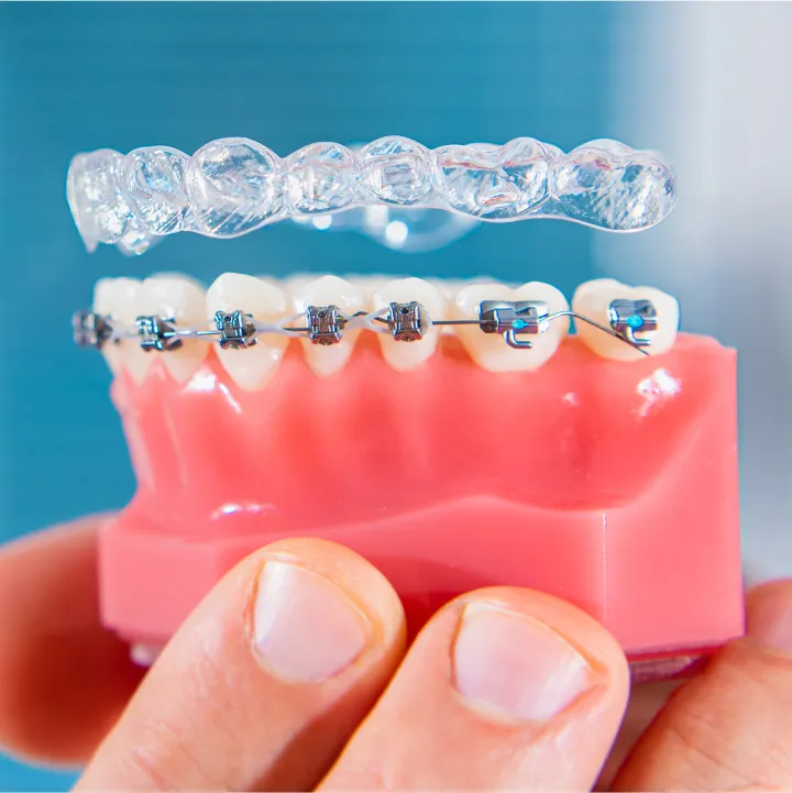 Invisalign or Braces? Compare the Best Orthodontic Treatments