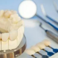How Long do Crowns Last on Front Teeth?