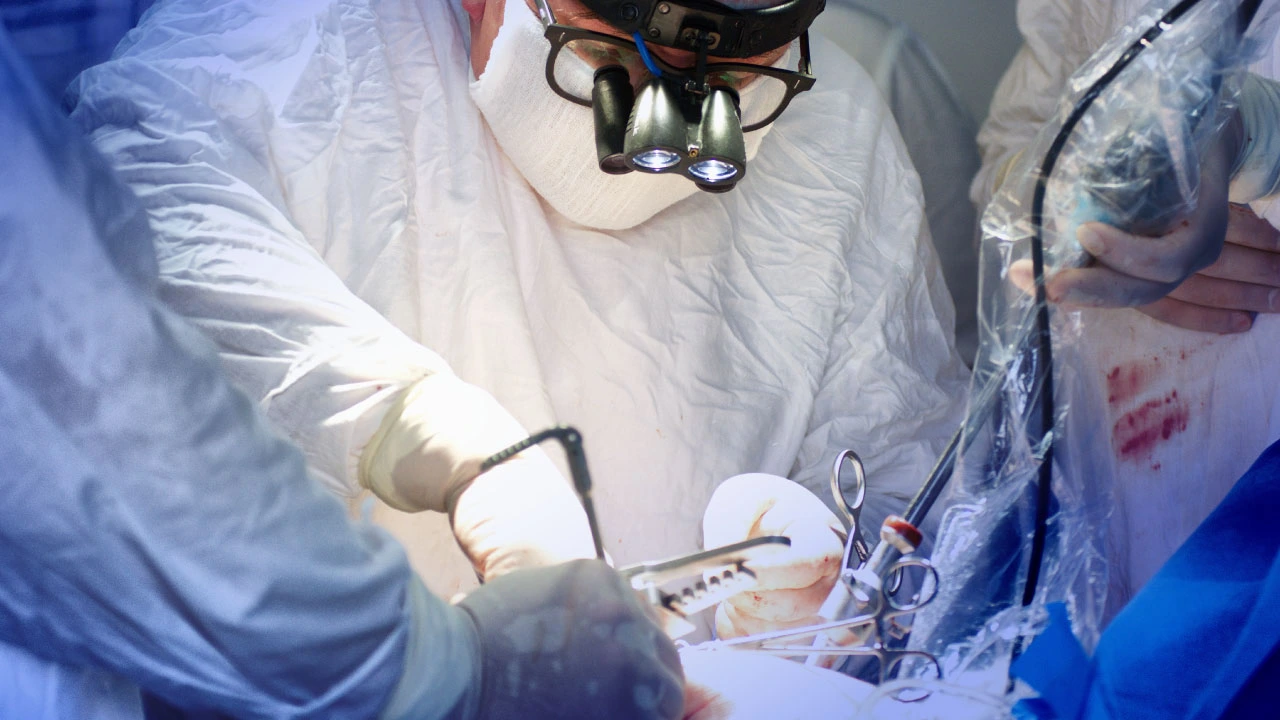 lung resection surgery diagram