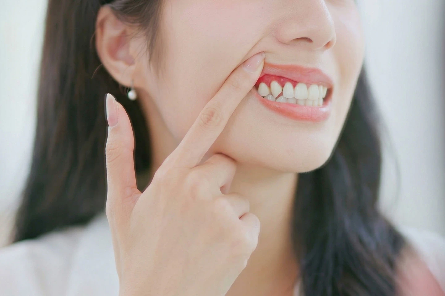 Periodontal Disease Management