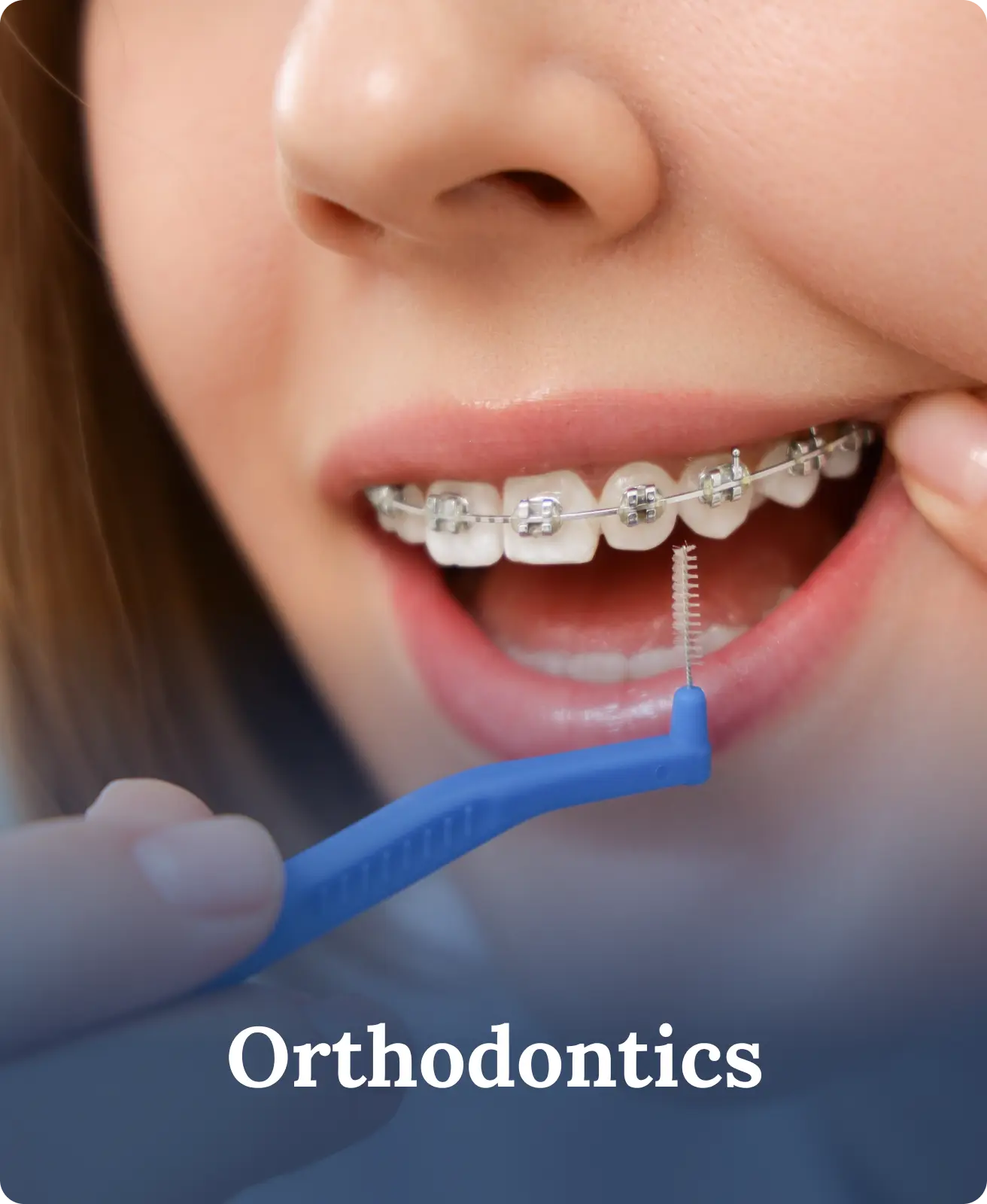Orthodontic Options for Adults: It’s Never Too Late to Straighten Your Smile
